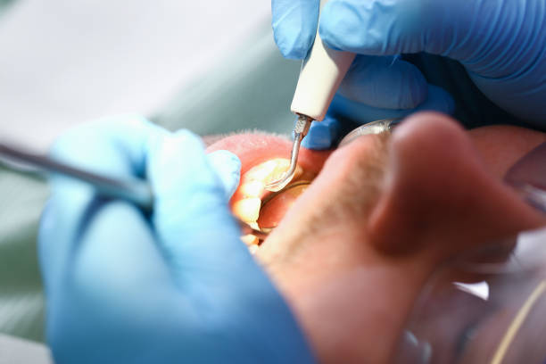 Best Emergency Dental Surgery in Parrish, AL